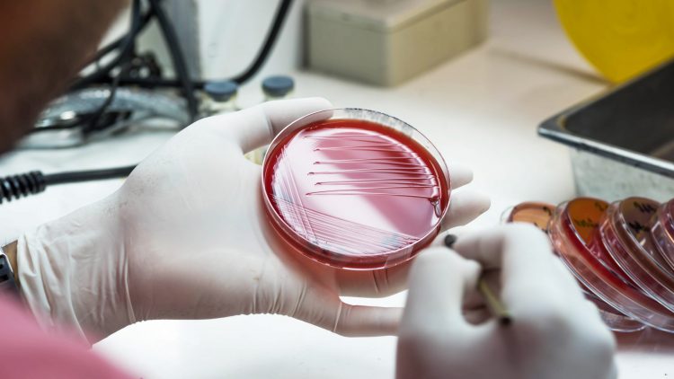 Agar plate in the hand of a medical technician working on bacterial culture and drug resistance.