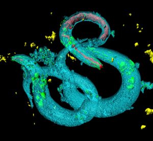 C elegans and Parkinson's disease