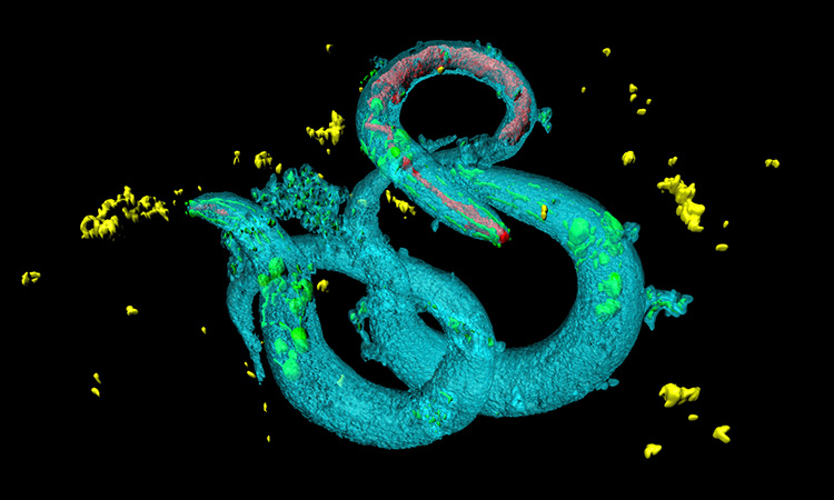 C elegans and Parkinson's disease