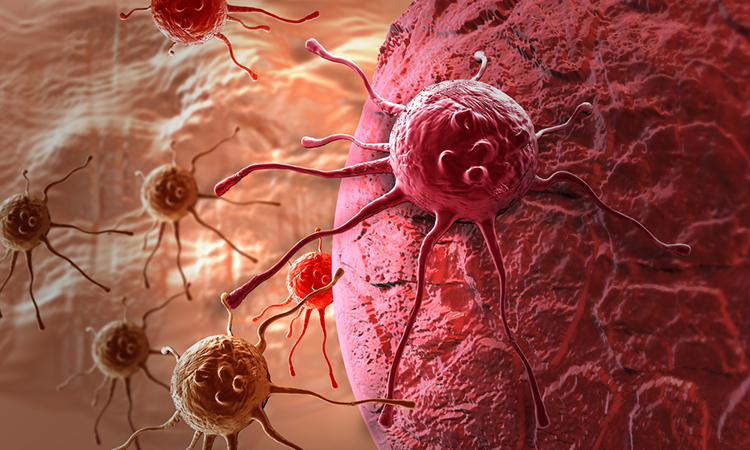 Cancer cells and immuno-oncology