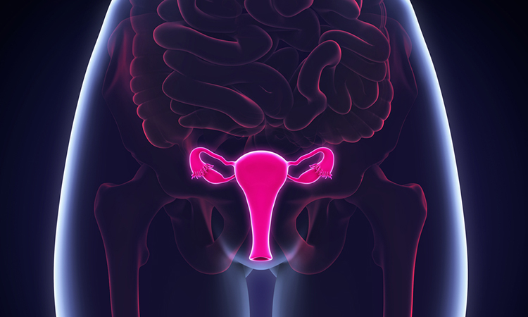 Cervical cancer organoids