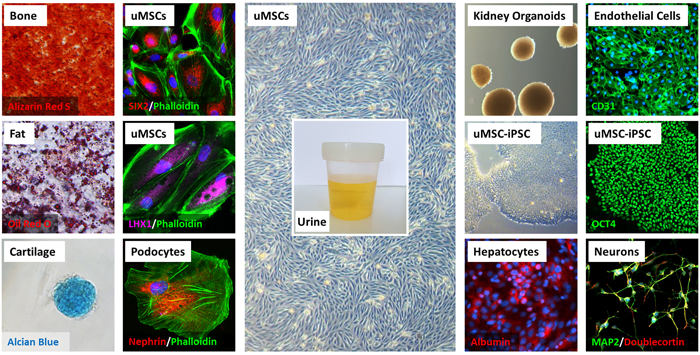 Urine-derived stem cells as innovative platform for drug testing and disease modelling