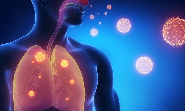 Flu in the lungs