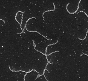 A microscopy image of Leptospira bacteria [Credit: Wunder et al. (CC BY 4.0)].
