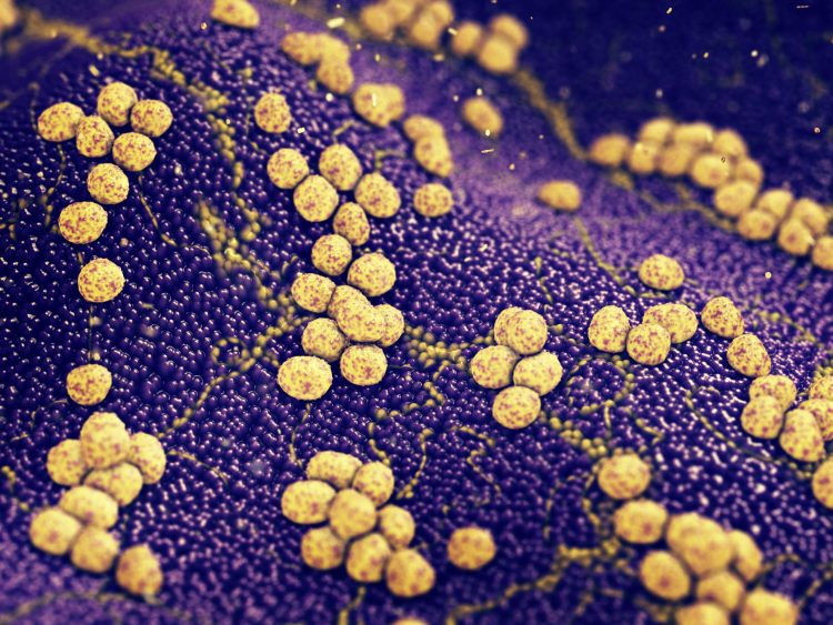 MRSA colonies in yellow on a dark blue background