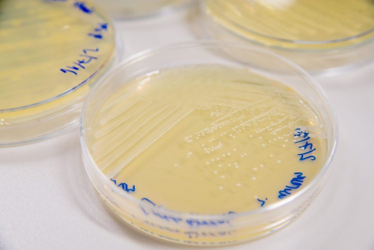 petri dishes containing bacterial colonies
