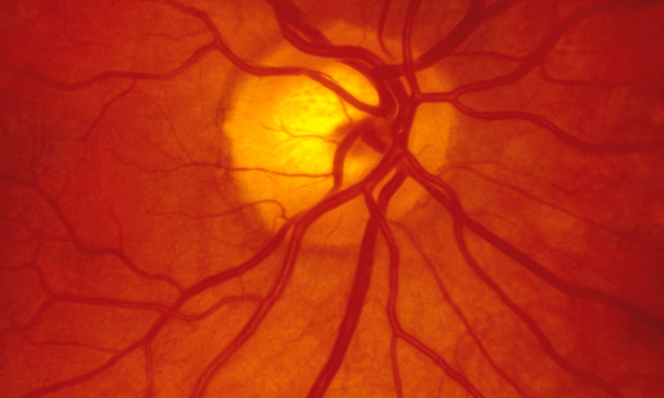 Inside of retina