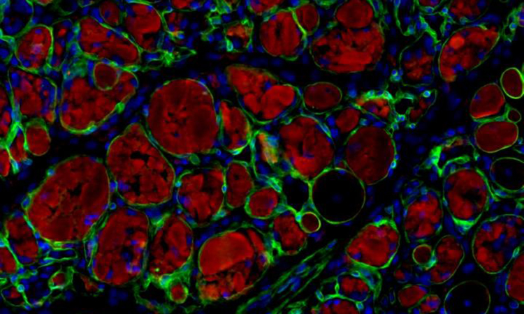 Muscle stem cells