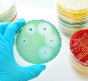 hand holding petri dish in which antibiotic sensitivity has been tested with bacteria, leaving rings surrounding paper disks containing compounds