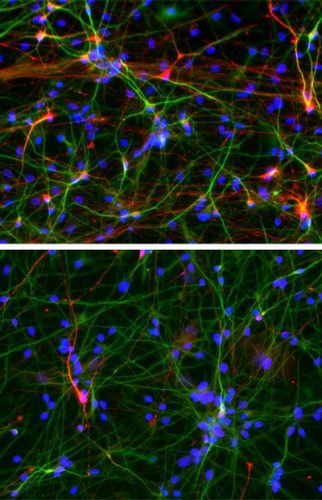 Unravelling the mechanism of excess brain growth in autism