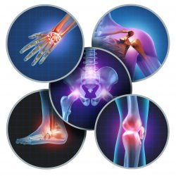 different joints affected by inflammation in arthritis
