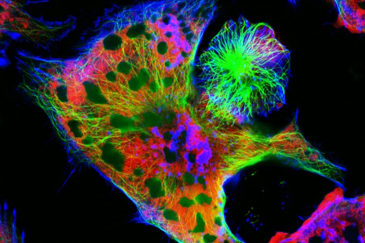 Neuroblastoma cells: nuclei are stained in red, microfilaments are in green and blue.