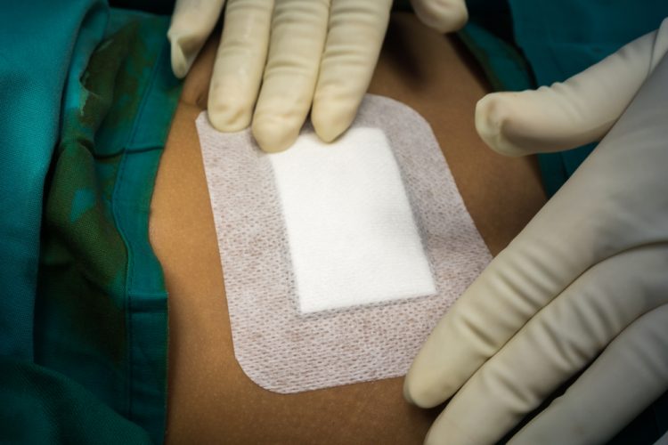 Doctor dressing a skin wound