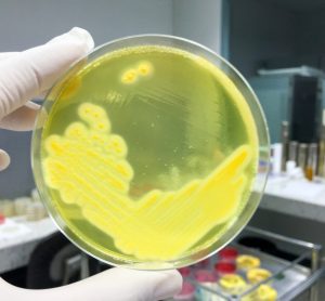 Staphylococcus Aureus grown in petri dish