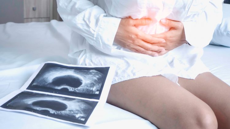 Woman holding stomach in pain next to scan of uterus