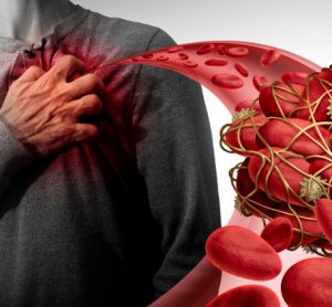 Illustration of blood clot with man holding chest in the background