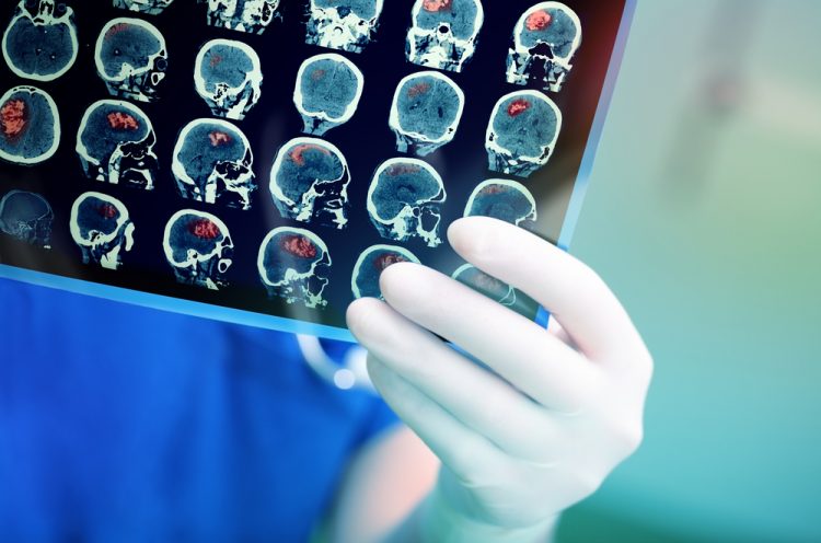 Doctor holding brain scan