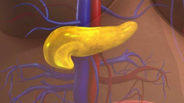 Glowing yellow pancreas in human torso - idea of diabetes, where pancreatic beta cells are destoryed