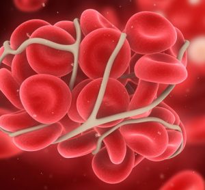 Assay of clotting ability accurately predicts need for transfusion in trauma patients