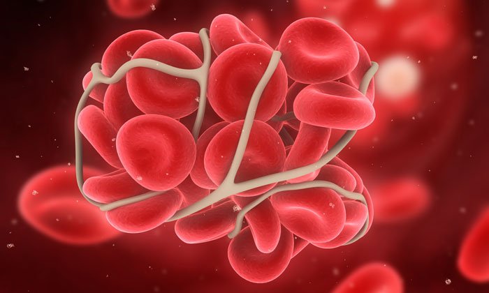 Assay of clotting ability accurately predicts need for transfusion in trauma patients