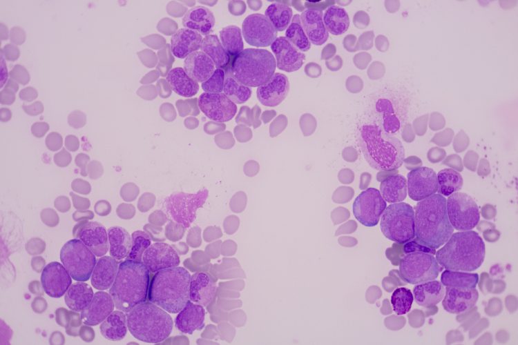 Tumour or cancer cells in blood